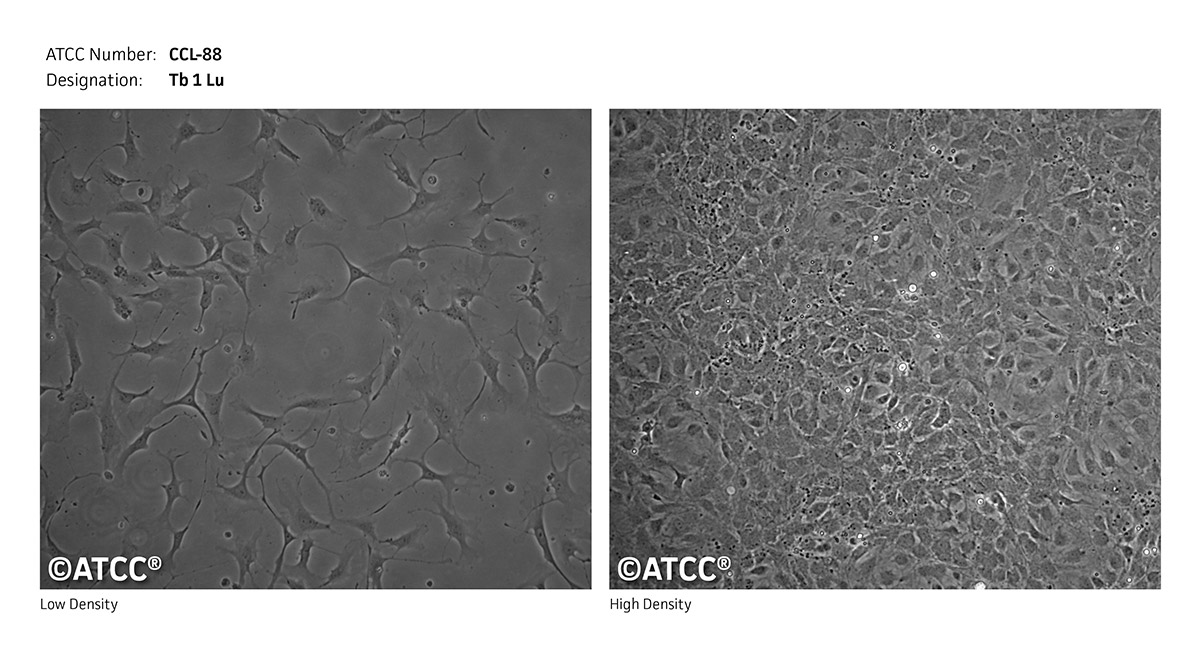 Tb 1 Lu细胞图片